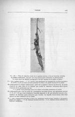 Fig. 185. Pièce de résection totale de la saphène interne et de ses branches atteintes de phlébite o [...]