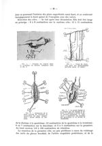 Fig. 4. Position de l'opéré dans la technique de Bérard / Fig. 5. Tracé de l'incision pour une thora [...]