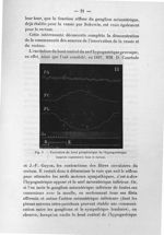 Fig. 3. Excitation du bout périphérique de l'hypogastrique - Notice sur les travaux scientifiques