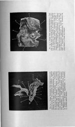 Fig. 23. Coupe horizontale d'un temporal droit passant au niveau du tiers supérieur du vestibule : s [...]