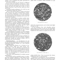 0541 - Page 477 - Chronique scientifique. Le café de sa décaféination. Étude chimique du grain de café / Cafés décaféinés