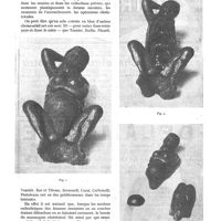 1115 - Page 985 - Curiosités. Deux anciens mannequins obstétricaux