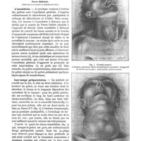 0053 - Page 49 - Ma technique de l'extirpation des goitres. Technique opératoire, par Pierre Sebileau. L'anesthésie / Les temps préparatoires