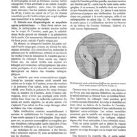 0116 - Page 112 - Diagnostic radiographique des calculs de l'uretère, par le Dr F. Arcelin. B. Calculs diagnostiqués et expulsés spontanément / C. Calculs non diagnostiqués et expulsés spontanément / D. Calculs non diagnostiqués et expulsés après cathétérisme / A. Ombres pelviennes non en rapport avec des calculs de l'uretère