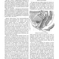 0149 - Page 139 - Traitement des retards de consolidation par le sérum de fracturé, par le Dr Th. Pétrault. Obs. II / Obs. III / Obs. IV / Contribution à l'étude des signes de la grossesse, par le Dr Dezwarte