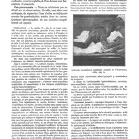 0187 - Page 191 - L'ecthyma vacciniforme syphiloïde infantile, par le Dr G. Petges et le Dr Ch. Rocaz. Historique / Cas personnels