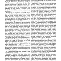 0311 - Page 295 - Sur la coxa valga, par le Dr Léon Dieulafé