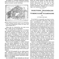 0514 - Page 514 - Nodosités juxta-articulaires et syphilis, par les Drs A. Cange et R. Argaud / Injections trachéales et tuberculose pulmonaire, par le Dr Balvay