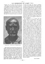 Fig. 3. - Alfred Pino. - Buste de M. le Pr Brindeau - Paris médical : la semaine du clinicien