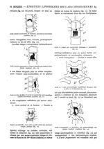 Fig. 9. - Arrêt massif transversal, en croissant, par tumeur intradurale (Laplane) / Fig. 10. - Arrê [...]