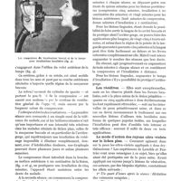 0080 - Page 70 - Le traitement du lichen plan par les rayons ultra-violets, par le Dr Élisabeth Skwirsky. Technique des irradiations / Les récidives / Le mode d'action des rayons ultra-violets sur le lichen plan