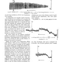 0093 - Page 83 - Éducation physiologique de la ventilation réflexe, par R. Goiffon et R. Waltz. Intérêt de la méthode / Résultats