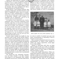 0019 - Page 1 - Variétés. L'oeuvre de préservation de l'enfance contre la tuberculose (oeuvre Grancher), par le Dr P.-F. Armand-Delille