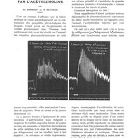 0125 - Page 111 - Les incidents cardio-vasculaires éventuels de la médication par l'acétylcholine, par Ch. Sarrouy et R. Raynaud