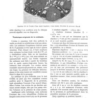 0399 - Page 381 - Dix ans de réaction hormonale de la grossesse, par S. Aschheim / Technique originale de la méthode