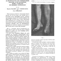 0439 - Page 421 - Considérations sur la gangrène dimidiée des extrémités chez les hémiplégiques (A propos d'un cas d'hémiplégie gauche avec gangrène homolatérale du membre inférieur), par MM. Maurice Villaret, Alain Rubens-Duval et Henri Péquignot