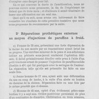 0022 - Page 21 - 2° Réparations prothétiques externes au moyen d'injections de paraffine à froid