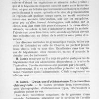0070 - Page 69 - M. Castex : Deux cas d'othématome. Intervention chirurgicale