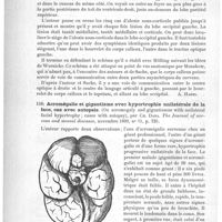 0118 - Page 114 - Analyses. Anatomie pathologique. 1° Un nouveau cas d'alexie avec hemianospie droite homonyme (alexie sous-corticale de Wernicke). Autopsie. - 2° Rapport sur la marche et l'examen anatomo-pathologique d'un autre cas..., sous le même titre, dans les n°s 17 et 18 du Centralblatt..., par L. Bruns... (Neurolog. Centralblatt...) / Acromégalie et gigantisme avec hypertrophie unilatérale de la face, cas avec autopsie (On acromegaly and gigantismus with unilateral facial hypertrophy ; cases with autopsy), par Ch. Dana. The Journal of nervous and mental diseases...