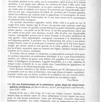 0119 - Page 115 - Analyses. Anatomie pathologique. Acromégalie et gigantisme avec hypertrophie unilatérale de la face, cas avec autopsie (On acromegaly and gigantismus with unilateral facial hypertrophy ; cases with autopsy), par Ch. Dana. The Journal of nervous and mental diseases... / Un cas d'hétérotopie de la substance grise dans les deux hémisphère cérébraux, par Magnus Matell. Archiv. für Psychiatrie und Nervenk...