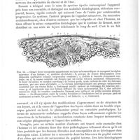 0501 - Page 497 - Analyses. Anatomie pathologique. La mésoneurite noduleuse, par Vanlair. Archives de neurologie...