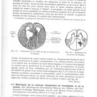 0590 - Page 586 - Analyses. Anatomie pathologique. Cas de gliomatose de la moelle (et syringomyélie) avec hémorrhagies (A case of gliomatosis of the spinal Cord (and syringomyelia), with recurrent haemorrhages), par Ch. Dana. The Journal of nervous and mental diseases... / Histologie de la sclérose disséminée de l'encéphale et de la moelle (Zur Histologie der disseminirten Sklerose des Gehirns und Rückenmarks-Vorläufige Mittheilung), von Dr. med. Michael Popoff... Neurologisches Centralblatt...