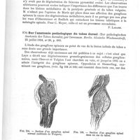 0720 - Page 716 - Analyses. Anatomie pathologique. De l'anatomie pathologique des cordons postérieurs de la moelle épinière, par le Dr Carl Mayer... Jahrbücher für Psychiatrie... / Sur l'anatomie pathologique du tabes dorsal (Zur pathologischen Anatomie der Tabes dorsalis), par Oppenheim. Berlin. klinische Wochenschrift...
