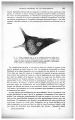 Fig. 9. Cellule radiculaire dans un cas de maladie de Parkinson. Malade âgé de 73 ans - Revue neurol [...]