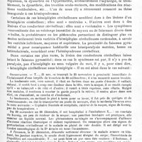 0505 - Page 505 - Société de neurologie de Paris. Séance du 6 mai 1918. Communications et présentations. XIV. Un cas d'hémisyndrome cérébelleux sans troubles pyramidaux (« Hémiplégie cérébelleuse » pure), par MM. André Léri et J. Thiers