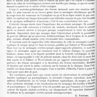1014 - Page 978 - Analyses. Neurologie. Études spéciales. Méninges. Nouvelle observation de méningite aiguë eberthienne à forme purulente. Présence de bacilles typhiques dans le liquide céphalo-rachidien, par Prosper Merklen et Cl. Gautier. Bulletins et mémoires de la Société médicale des hôpitaux de Paris... / Nerfs périphériques. Sur le diagnostic de la sciatique, par Vincenzo Giordano. Il Morgagni...