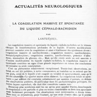 0415 - Page 339 - Actualités neurologiques. La coagulation massive et spontanée du liquide céphalo-rachidien, par Lantuéjoul