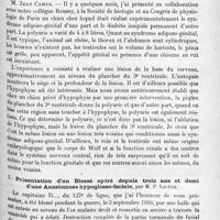 1197 - Page 1113 - Société de neurologie de Paris. Séance du 4 novembre 1920. Communications et présentations. IX. Tumeur du IIIe ventricule avec compression de l'hypophyse et sans syndrome infundibulaire, par MM. H. Claude et H. Schaeffer / X. Présentation d'un blessé opéré depuis trois ans et demi d'une anastomose hypoglosso-faciale, par M. P. Lecène
