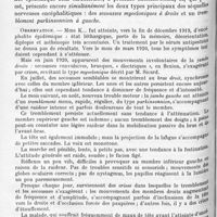 1294 - Page 1210 - Société de neurologie de Paris. Séance du 2 décembre 1920. Communications et présentations. VI. Deux séquelles encéphalitiques juxtaposées chez un même sujet : secousses myocloniques à droite ; tremblement parkinsonnien à gauche, par M. Henry Meige