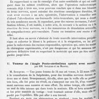 1302 - Page 1218 - Société de neurologie de Paris. Séance du 2 décembre 1920. Communications et présentations. X. Causalgie du sciatique guérie par la radicotomie, par MM. Sicard et Robineau / XI. Tumeur de l'angle ponto-cérébelleux opérée avec succès, par MM. Souques et de Martel