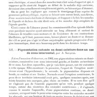 0214 - Page 202 - Société de neurologie de Paris. Séance du 3 février 1921. Communications et présentations. XI. Atrophie spinale croisée avec contractions fibrillaires marquées chez un enfant de 12 ans, par M. Jules Renault, Mme Athanassio-Bénisty et M. E. Libert / XII. Pigmentation cutanée en demi-ceinture dans un cas de zona intercostal, par A. Souques