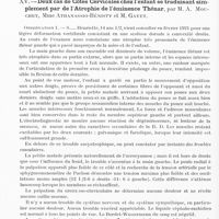 0780 - Page 758 - Société de neurologie de Paris. Séance du 2 juin 1921. Communications et présentations. XIV. Fausse griffe cubitale par lésion dissociée du nerf radial, par M. J. Jumentié / XV. Deux cas de côtes cervicales chez l'enfant se traduisant simplement par de l'atrophie de l'éminence Thénar, par M. A. Mouchet, Mme Athanassio-Bénisty et M. Gayet