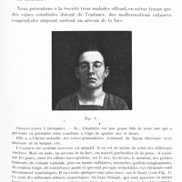 1161 - Page 1127 - Société de neurologie de Paris. Séance du 3 novembre 1921. Communications et présentations. I. Syndrome strié à type facial (masque de crispation), par MM. Sicard et Forestier / II. Epilepsie et malformations congénitales de la peau (adénomes sébacés et noevi vasculaires), par MM. Souques, Alajouanine et R. Mathieu