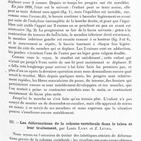 0099 - Page 51 - Société de neurologie de Paris. Séance du 1er juillet 1926. Discussions et communications. II. Paraplégie par paralysie infantile. Arthrodèses multiples permettant la marche, par Etienne Sorrel et Mme Sorrel-Dejerine / III. Les déformations de la colonne vertébrale dans le tabes et leur traitement, par Louis Lamy et J. Leuba