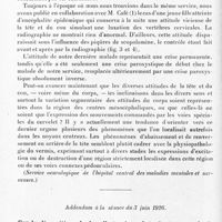 0144 - Page 96 - Société de neurologie de Paris. Séance du 1er juillet 1926. Discussions et communications. XII. Déviation de la tête et des yeux apparaissant par crises en même temps qu'une paralysie faciale périphérique opposée, par D. Paulian... / Addendum à la séance du 3 juin 1926. Sur la disparition de la selle turcique dans les tumeurs de la loge cérébrale postérieure. Les erreurs de diagnostic qui en sont la conséquence, par M. Clovis Vincent...