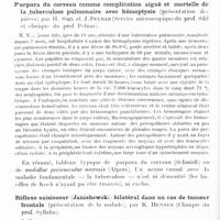 0596 - Page 528 - Société de neurologie (Société Purkyne) de Prague. Séance du 6 février 1929. Intoxication par le gaz d'éclairage. Mort dans le coma après trois jours. Malacie symétrique dans le noyau palidal (présentation de la pièce), par H. Sikl et J. Pelnar (Clinique du Prof. Pelnar et Institut pour anatomie pathologique du Prof. Kimla) / Purpura du cerveau comme complication aiguë et mortelle de la tuberculose pulmonaire avec hémoptysie (présentation des pièces), par H. Sikl et J. Pelnar (Service microscopique du Prof. Sikl et clinique du Prof. Pelnar) / Réflexe saisisseur (Janishewski) bilatéral dans un cas de tumeur frontale (présentation de la malade), par K. Henner (Clinique du Prof. Syllaba)