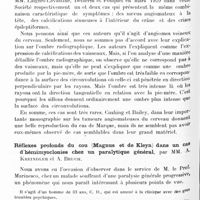 1223 - Page 1154 - Société de neurologie de Paris. Séance du 6 juin 1929. Calcifications des méninges (angiomes du cerveau) démontrées par la radiographie, par M. Knud Krabbe / Réflexes profonds du cou (Magnus et de Kleyn) dans un cas d'hémimyoclonies chez un paralytique général, par MM. A. Kreindler et A. Bruch
