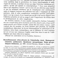 1292 - Page 1238 - Société de neurologie de Paris. Séance du 22 mai 1930. Les lésions du système nerveux central dans le zona, par MM. Jean Lhermitte et Vermès (Travail du laboratoire de la fondation Dejerine.) / Ramollissement rétro-olivaire de l'hémibulbe droit. Nystagmus rotatoire antihoraire. Syndrome sympathique. Voies sympathiques bulbaires, par MM. André-Thomas, Hamet et Bars