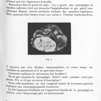 0147 - Page 91 - Société de neurologie de Paris. Séance du 6 juillet 1933. Communications. Paraplégie flasque foudroyante. Méningiome spinal avec hémorragies intra et péritumorales, par MM. J. Lévy-Valensi, Justin-Bezançon, Cuel et Leblanc / L'importance diagnostique de l'artériographie de la fosse postérieure, par MM. Egas Moniz et Abel Alves