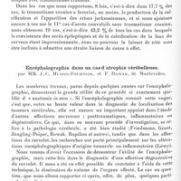0710 - Page 662 - Société de neurologie de Paris. Séance du 5 mars 1936. Calcification de la faux de la dure-mère du cerveau, par MM. D. Paulian, S. Sfintescu et C. Fortunescu. (Travail du service neurologique et radiologique de l'hôpital des maladies mentales, nerveuses et endocriniennes de Bucarest) / Encéphalographie dans un cas d'atrophie cérébelleuse, par MM. J.-C. Mussio-Fournier, et F. Rawak...