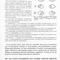0161 - Page 119 - Société de neurologie de Paris. Séance du 6 mars 1941. Sur une modalité de l'hémorragie des pédoncules cérébraux : syndrome de Parinaud, syndrome oculo-sympathique, iridoplégie, exaltation des réflexes dits de défense. Phénomène d'Hertwig-Magendie, hallucinose et onirisme, par J. Lhermitte et Mme Bussière de Robert / Sur une variété d'encéphalose avec atrophie cérébrale objectivée in vivo par l'encéphalographie et vérifiée chirurgicalement. Biopsie, par J. A. Chavany et S. Daum