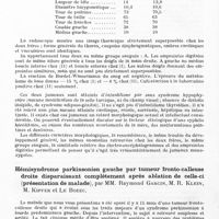 0110 - Page 80 - Société de neurologie de Paris. Séance du 4 mars 1943. Infantilisme pur chez deux jumeaux monozygotes, par MM. Georges Guillain et Marcel Rouzaud / Hémisyndrome parkinsonien gauche par tumeur fronto-calleuse droite disparaissant complètement après ablation de celle-ci (présentation de malade), par MM. Raymond Garcin, M. R. Klein, M. Kipfer et Le Bozec