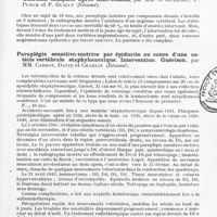 0167 - Page 137 - Société de neurologie de Paris. Séance du 1er avril 1943. L'épreuve du cloche-pied vestibulaire, par M. J.-A. Barré / Angiome vertébral coexistant avec deux angiomes épiduraux. Guérison complète après intervention, par MM. G. Guillain, P. Puech et P. Guilly (Résumé) / Paraplégie sensitivo-motrice par épidurite au cours d'une ostéite vertébrale staphylococcique. Intervention. Guérison, par MM. Carrot, David et Charlin (Résumé)