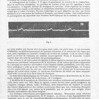 0177 - Page 147 - Société de neurologie de Paris. Séance du 6 mai 1943. Myotonie atrophique, à forme hémiplégique, avec troubles du rythme cardiaque d'origine neurovégétative, par MM. Carrot, Charlin et Paraire (Résumé)