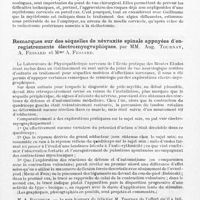 0183 - Page 153 - Société de neurologie de Paris. Séance du 10 juin 1943. Névrite ascendante datant de 14 ans. Disparition de la causalgie et des troubles vaso-moteurs après radicotomie cervicale postérieure. Discussion des indications respectives de la radicotomie et de la myélotomie en pareil cas, par MM. Marcel David et H. Hecaen (résumé) / Remarques sur des séquelles de névraxite spinale appuyées d'enregistrements électromyographiques, par MM. Aug. Tournay, A. Fessard et Mme A. Fessard