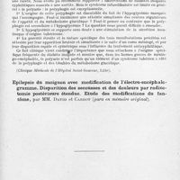 0323 - Page 293 - Société de neurologie de Paris. Séance du 4 novembre 1943. Diabète insipide dans un cas de méningo-encéphalite syphilitique : polyurie, polyphagie et troubles de la régulation glycémique, par MM. Carrière et P.-J. Gineste... (Clinique médicale de l'Hôpital Saint-Sauveur, Lille) / Epilepsie du moignon avec modification de l'électro-encéphalogramme. Disparition des secousses et des douleurs par radicotomie postérieure étendue. Etude des modifications du fantôme, par MM. David et Carrot